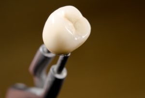 Dental crown in laboratory