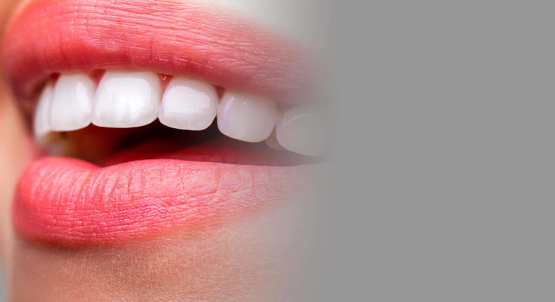 Dental Implants & Crowns