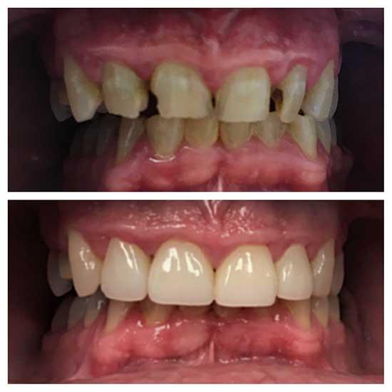 patient unhappy with smile transformed 